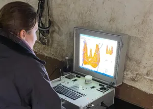 Grafische Darstellung der Schilddrüse mit dem Metavital-Scan